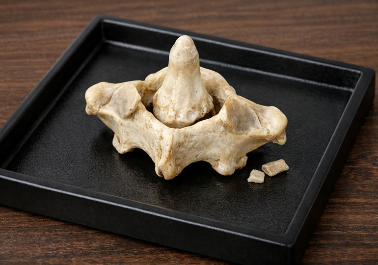 喉仏と言われている第二頸椎（軸椎）の画像